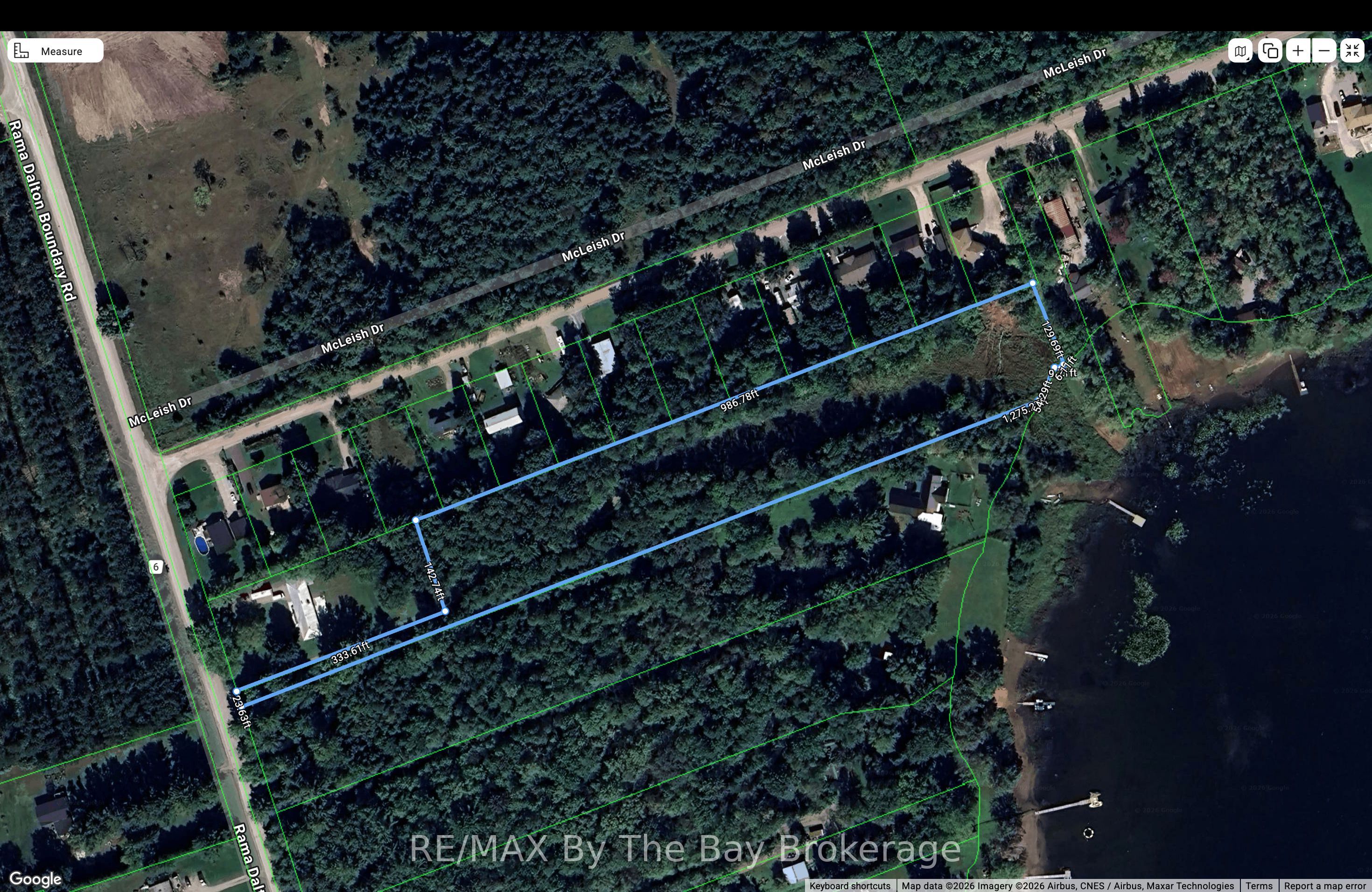 000 Rama Dalton Boundary Road, Kawartha Lakes, ON L0K 1W0 photo 3